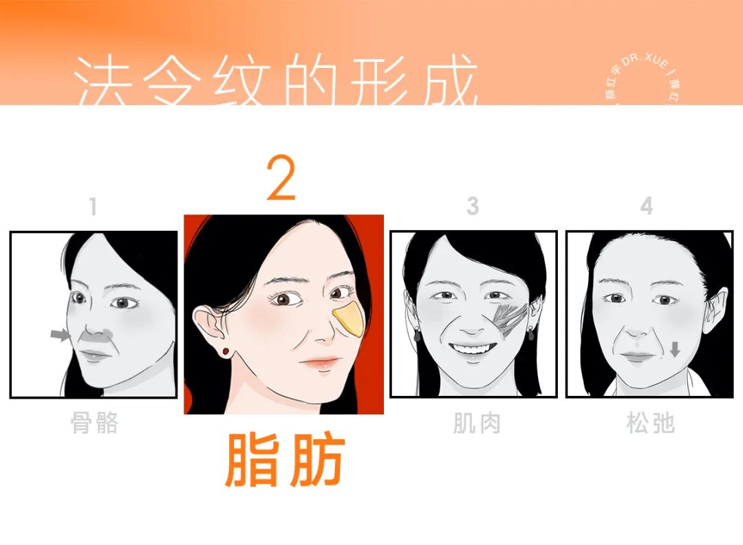 怎样改善川字纹和法令纹,脾胃好了法令纹会改善吗