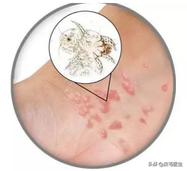 猫狗之间互相传染的病,猫狗耳螨互相传染怎么根治