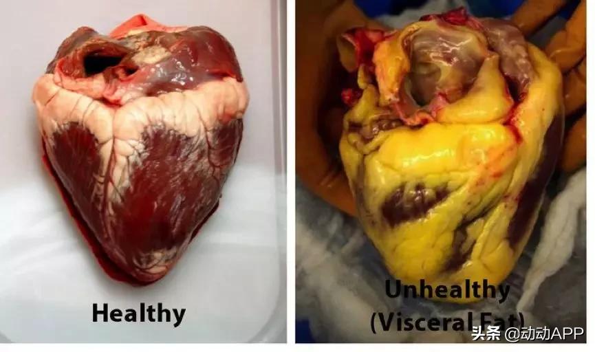 腰肥一寸命短十年,腰长一寸寿减十年