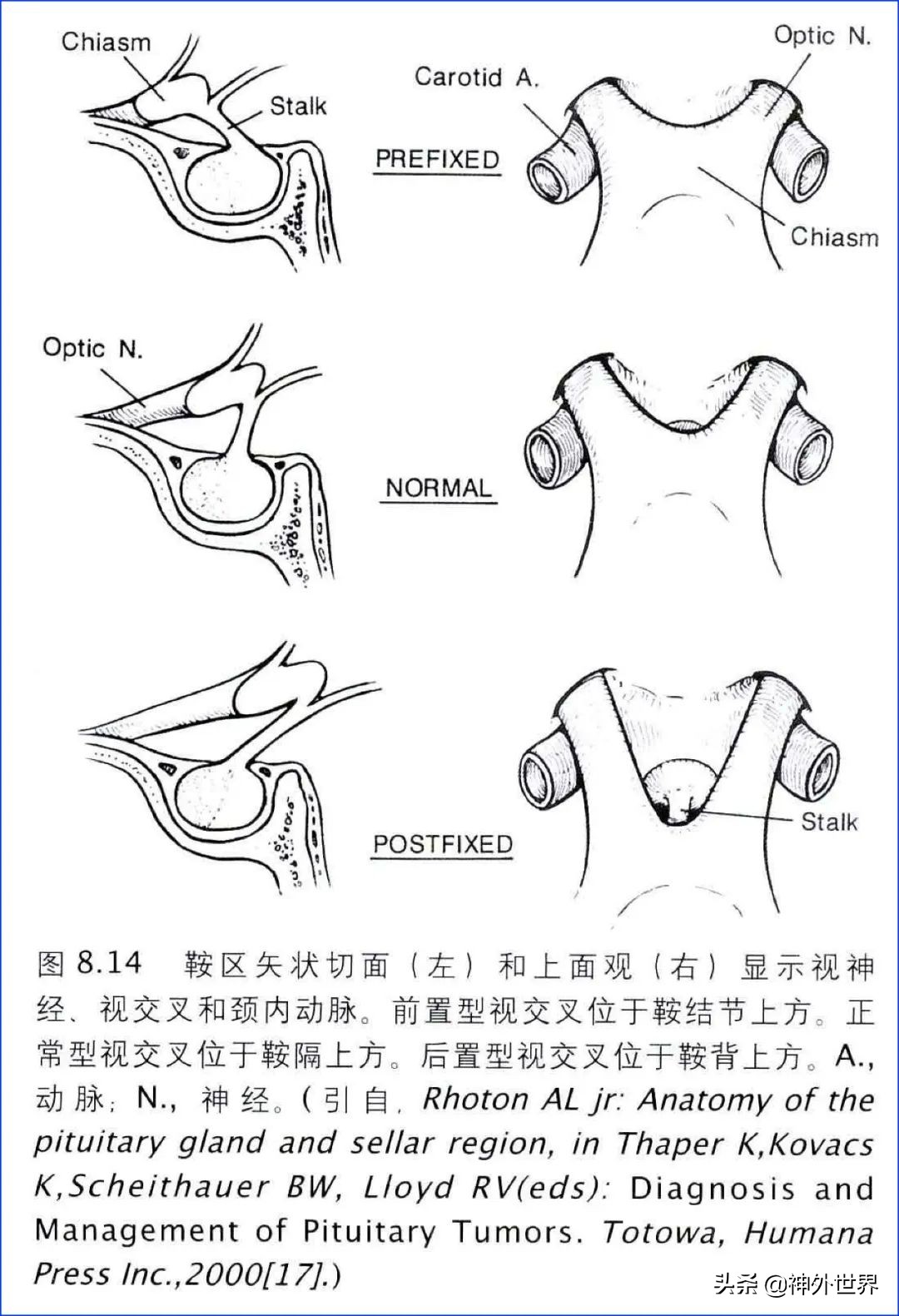 鞍区解剖学习笔记之——垂体