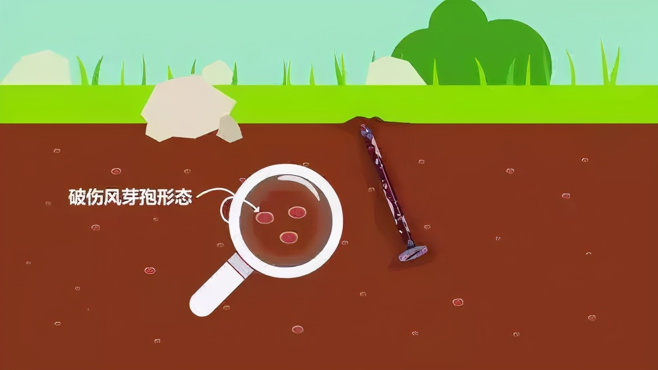 外伤处理后必须要打破伤风吗,受伤后为什么要打破伤风针