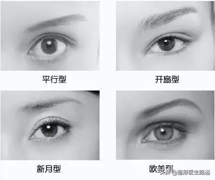 西安哪家双眼皮做的好,西安医美整形双眼皮