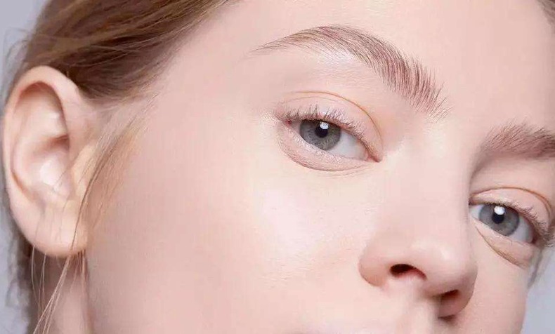 笑起来眼纹特别重怎么去除,笑起来有眼纹正常吗