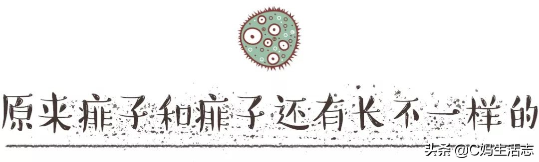 长痱子怎么办小妙招,夏天长痱子有什么食疗方法