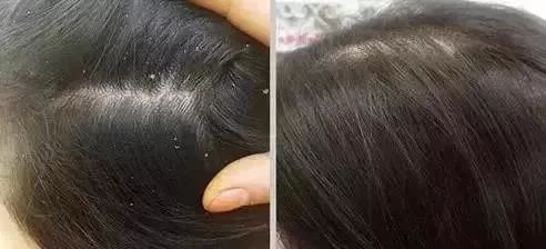 清爽头皮不掉发洗发露,洗发露去屑止痒留香持久干头发