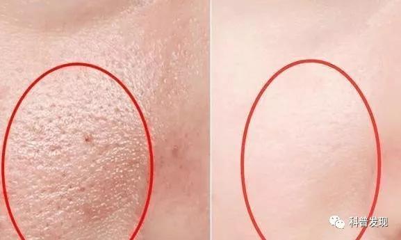 既能涂脸又能涂身体的乳液,乳液涂抹在脸上有什么效果