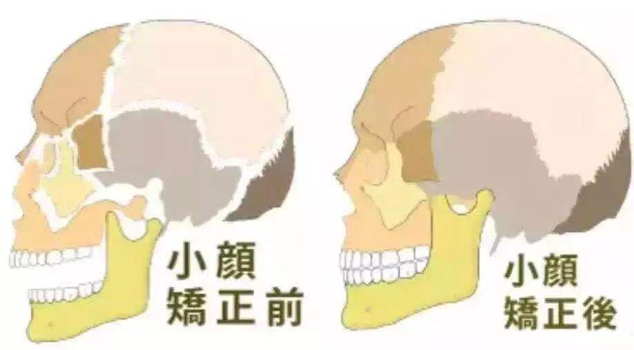 雷佳音显脸小技能,雷佳音片场物理瘦脸