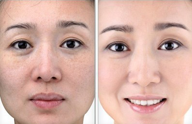 护肤品买套盒还是单买好,护肤品买单品好还是套装好