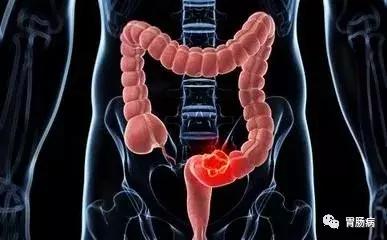 体检正常为什么突然查出有癌症,体检发现肿瘤是恶性的吗