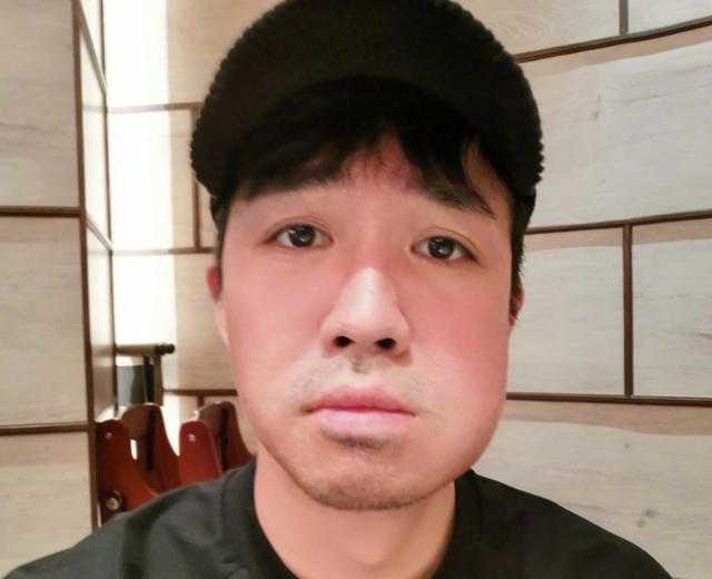 俞灏明现在脸部修复,俞灏明牙龈上火原因