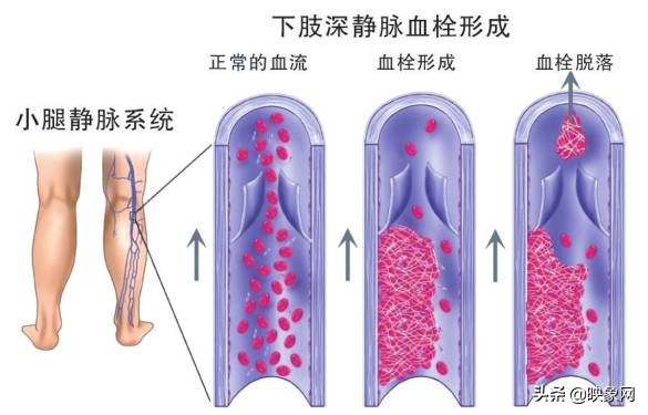 离死亡不远之前的表现,离死亡最近的一次经历是什么感受