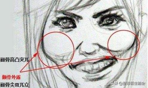 颧骨高显得老,颧骨特别高长胖会不会变好