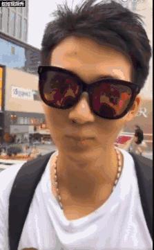 肿眼泡是什么原因啊,肿眼泡怎么贴双眼皮