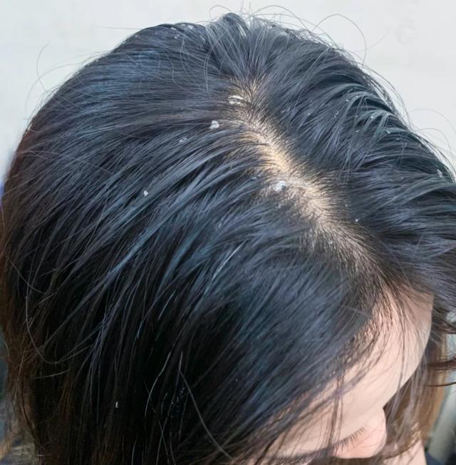 判断自己什么发质,判断自己发质细软还是粗硬