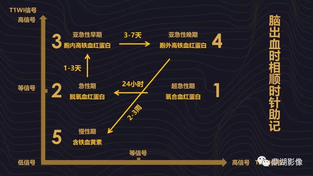 不简单|脑出血超详细学习笔记