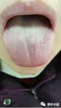 失眠就用这四味药,失眠就用四物汤