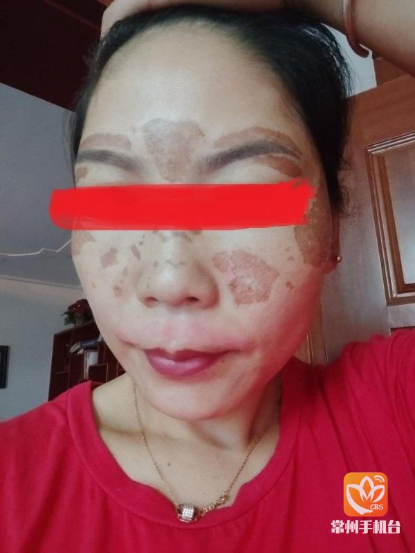 深度调查祛斑美容,祛斑美容内幕