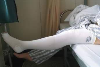 70岁老人不活动就感觉呼吸费劲,老人不咳但呼吸困难是什么原因