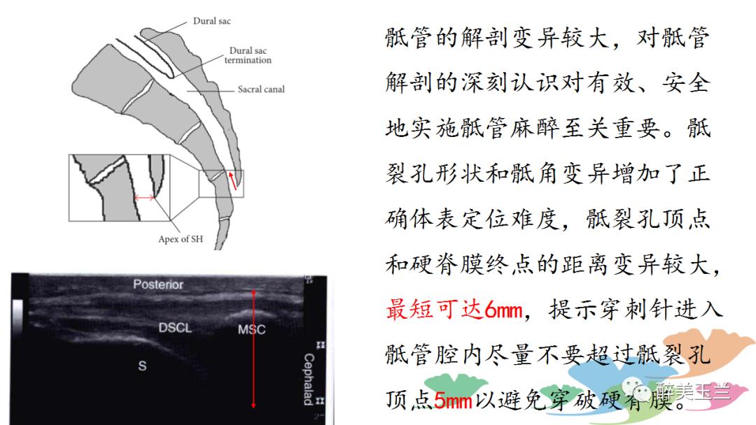 局麻药中毒的术前用药口诀,局麻药中毒临床表现及处理流程ppt