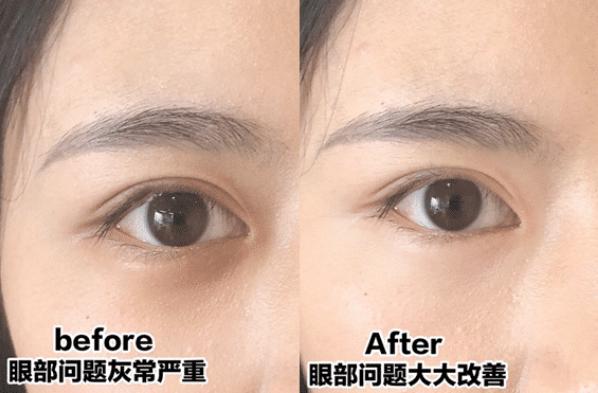 屈臣氏号称“眼部熨斗”的眼霜，李佳琦也推荐过，效果看得见