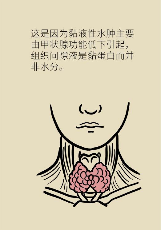 女性经期小腿以下水肿怎么办,起床肿怎么办