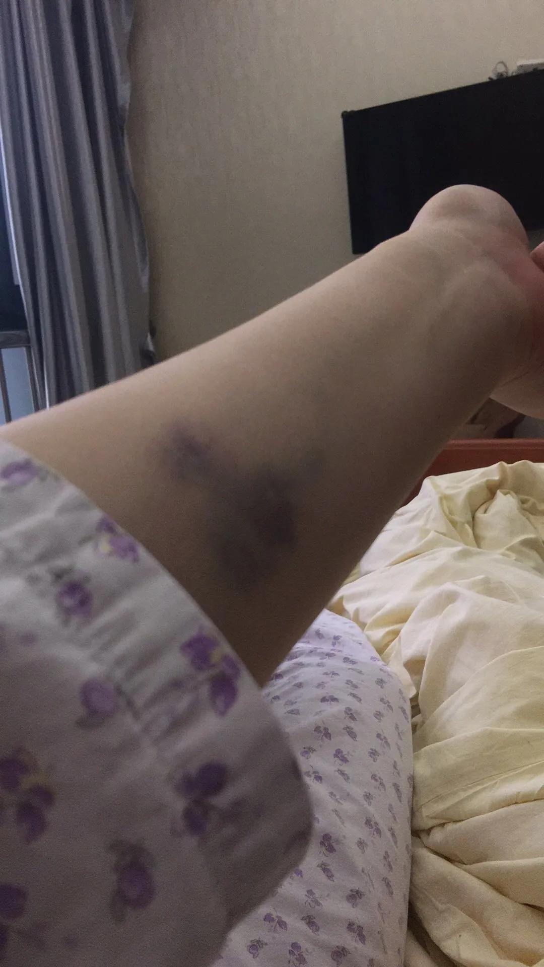 当取卵针戳进我的卵巢时，丈夫在看片取精|成为母亲