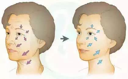 做了微整之后的感悟,微整经验