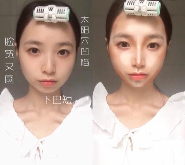 如何消除双下巴让脸型更好看,下巴松弛造成的双下巴面相