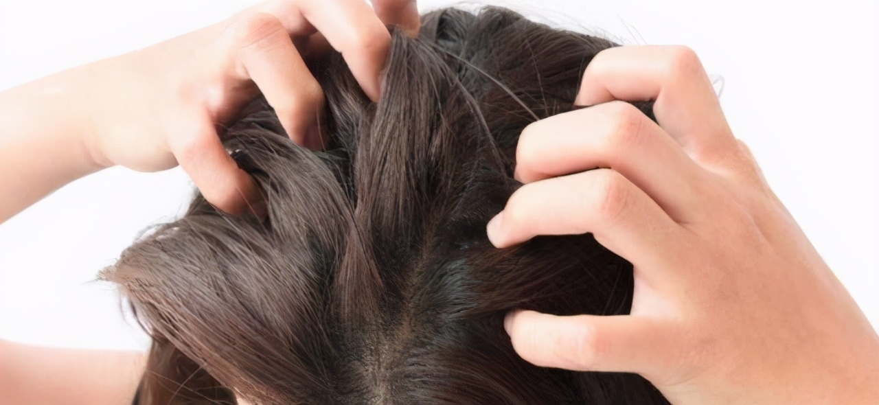 哺乳期头上痒有头皮屑起疙瘩,头上有大块的头皮屑胸下面有疙瘩