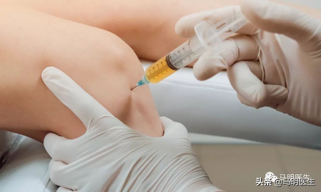 膝关节骨性关节炎治疗指南2018,膝关节骨性关节炎循证医学指南