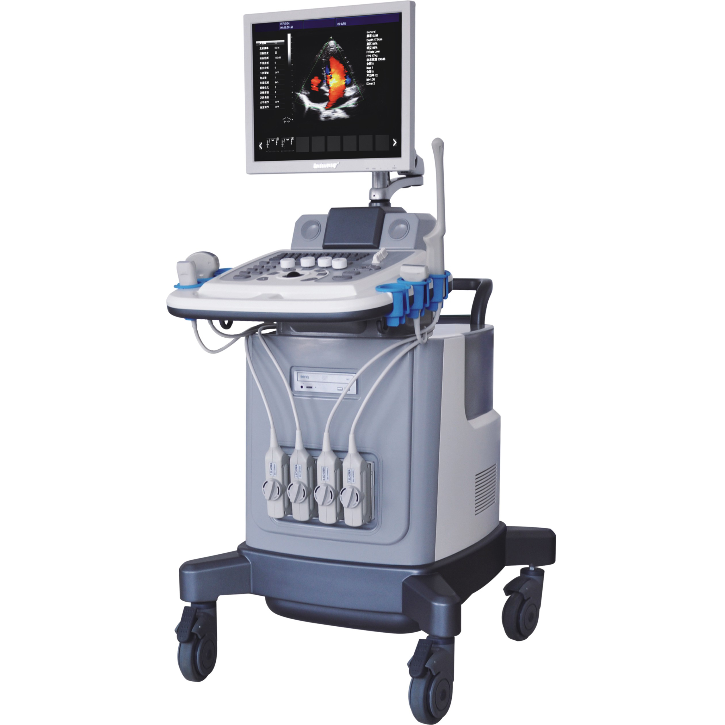 彩超检查出现的黑白图像，是“上当受骗”？还是“理所应当”？