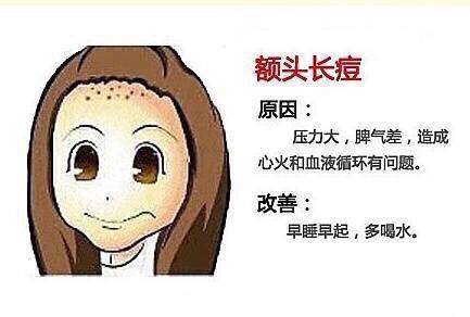 额头下巴长痘痘的原因和解决方法,额头下巴长痘痘的原因和改善方法