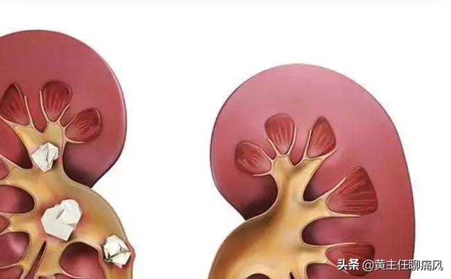 碳酸氢钠片辅助降尿酸如何吃,碳酸氢钠一天一片可以碱化尿液吗