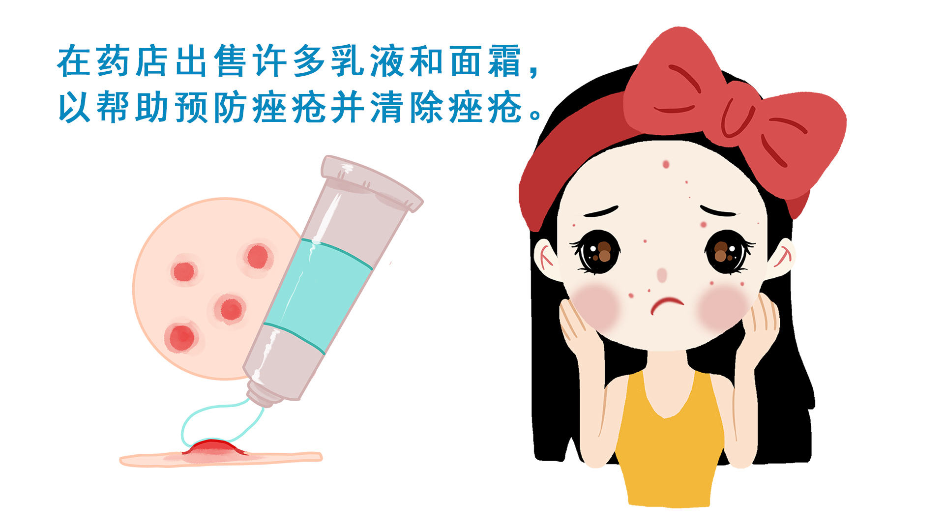 小孩青春期长痘痘了该怎么消除,孩子青春期脸上长痘要不要重视