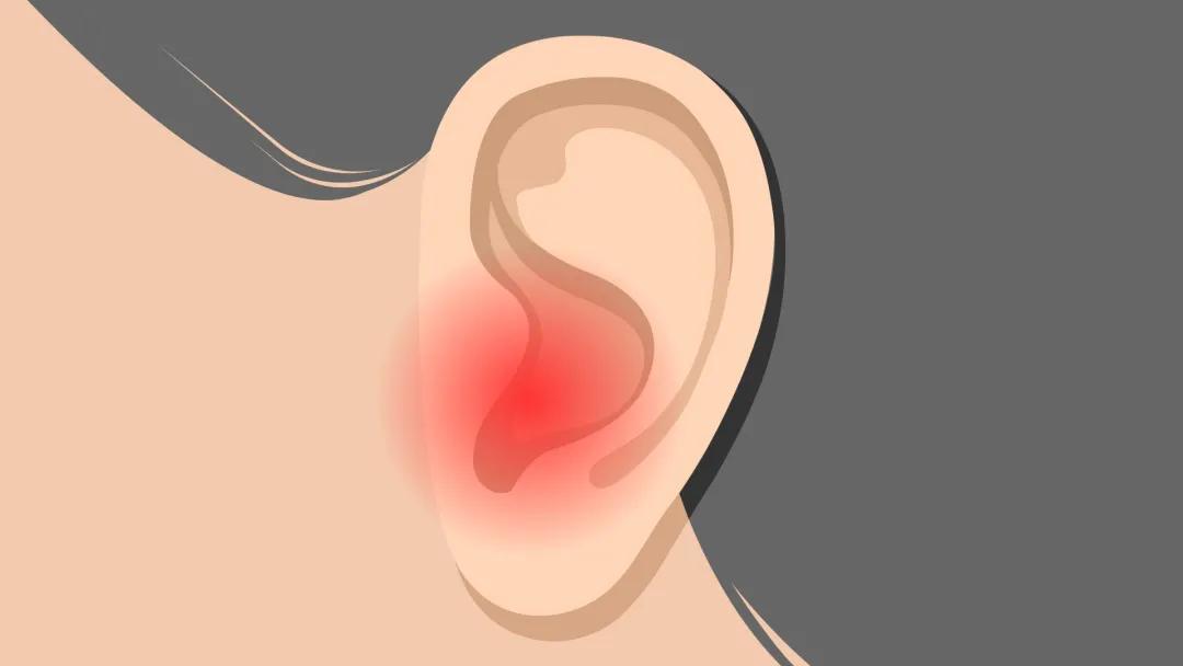 坐飞机耳朵里剧痛怎么回事,坐飞机导致耳朵不舒服出血了