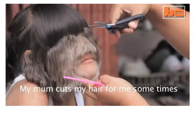 王大妈儿媳妇花了1W脱毛后才明白,千万不要轻易去脱毛