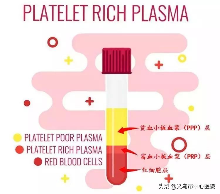 骨关节病变的克星,骨关节炎克星