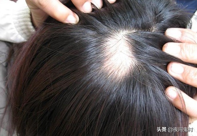 古人言白发为什么不能拔,拔头发习俗