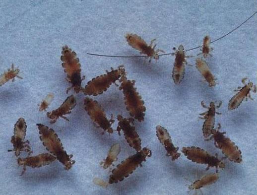 如何去除头上的虱子和虱卵,虱子的生成过程及去除头虱的方法