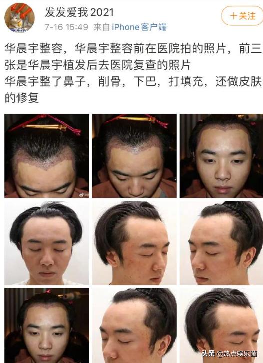 华晨宇张碧晨台湾新闻,天涯爆料华晨宇和张碧晨