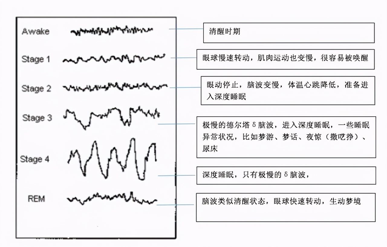 睡眠剥夺实验你能撑几天,苏联睡眠剥夺实验完整版视频