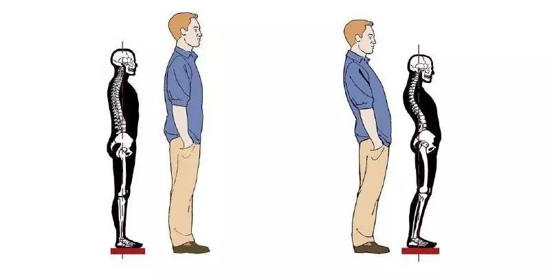 膝关节超伸原因以及调理方法