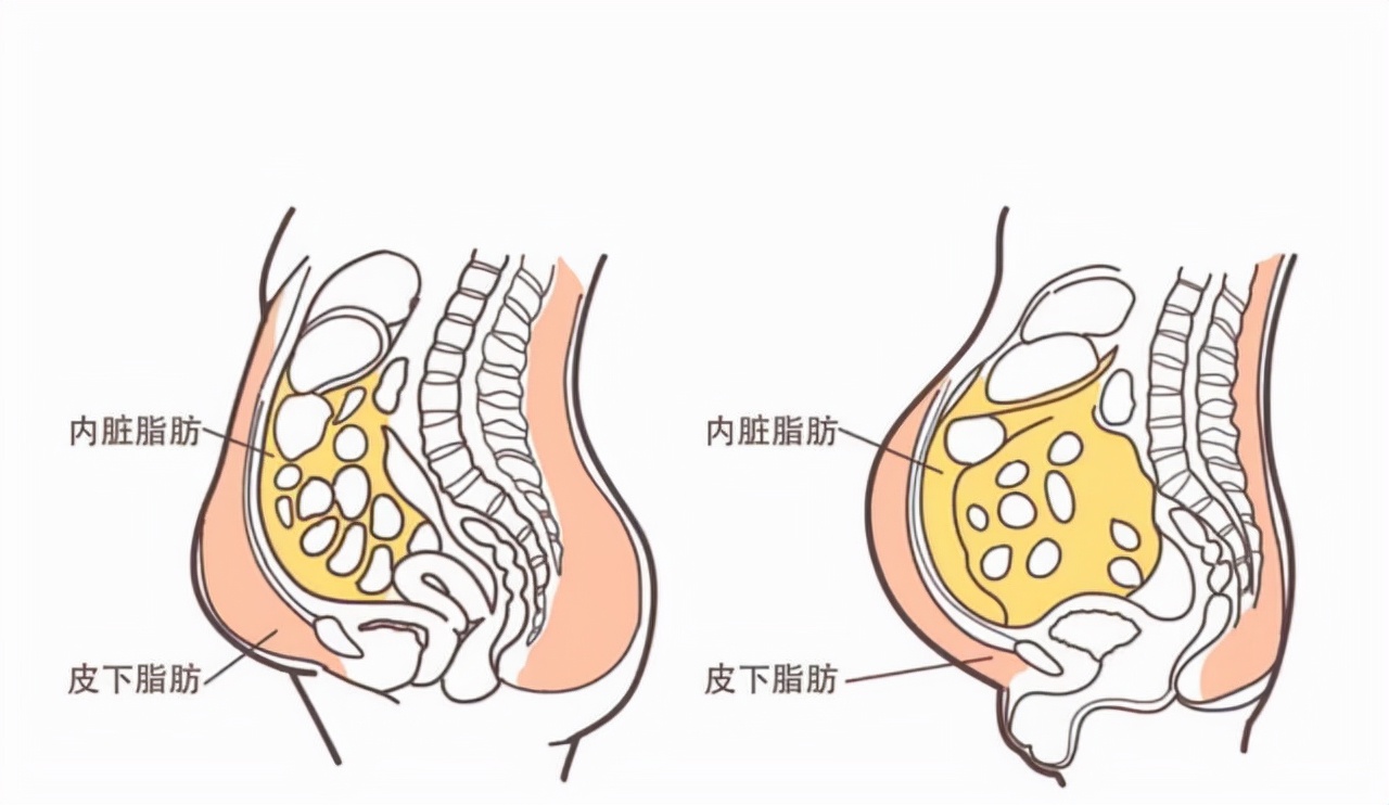 天天跑步内脏脂肪过高怎么减,跑步减内脏脂肪几天有效果