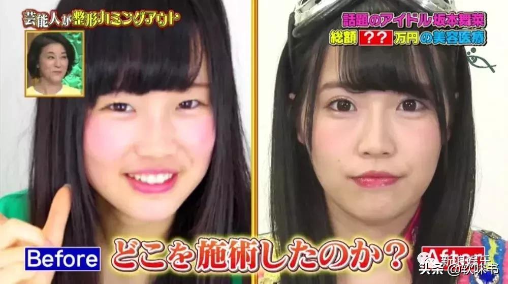 整容脸vs自然脸同龄女星对比,明明是整容脸却没被吐槽过