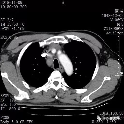 怎么应用统计学做调查,统计学方法可以解决的主要问题