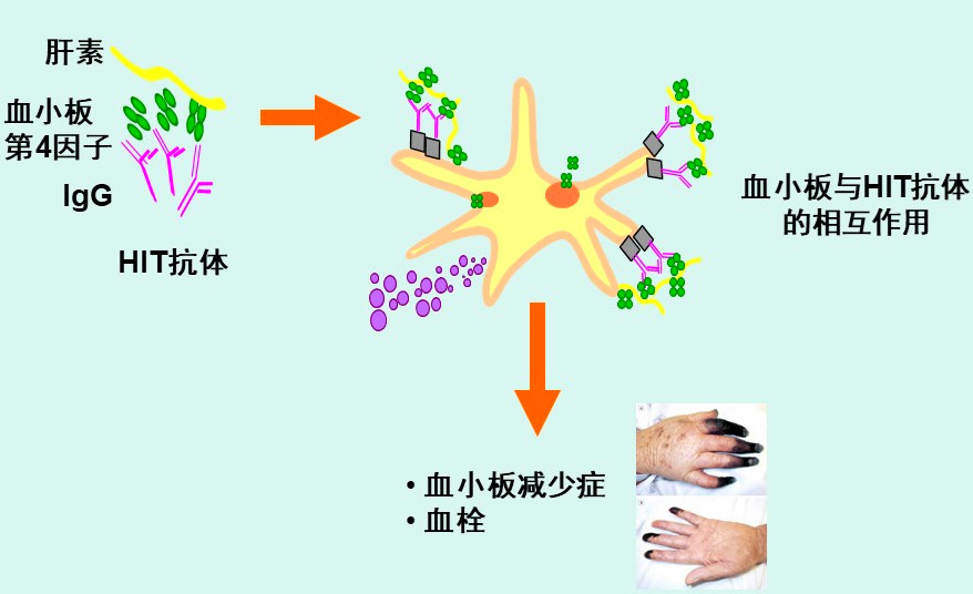 孕吐输液葡萄糖和维生素b6,孕吐输液为什么会血压血糖下降