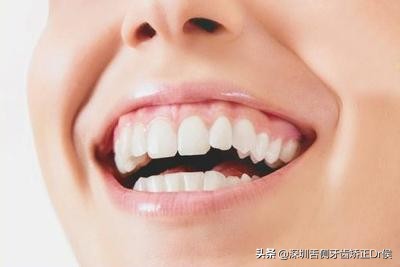 露龈笑原因,露龈笑矫正