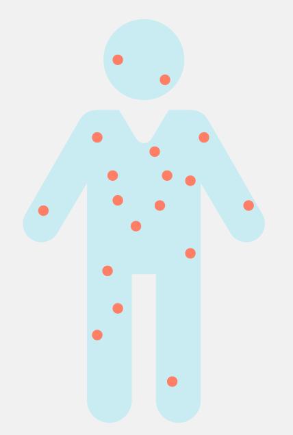 “脚气”有神传染力，脚气能传染到全身？如何预防？