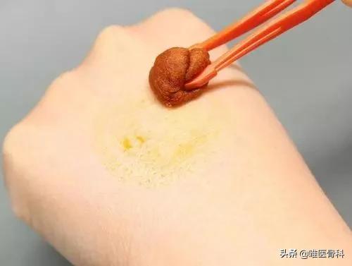 常用的四种消毒液,消毒液一般情况下是不建议用