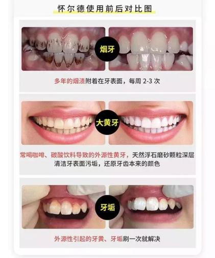 李湘贵妇,李湘美白牙膏